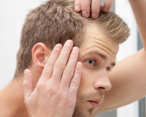 combattere lalopecia 10 soluzioni efficaci